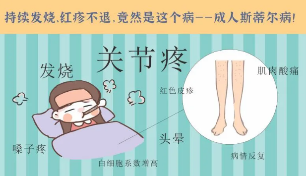 持續(xù)發(fā)燒、紅疹不退……她終于在這里治好了這個罕見病