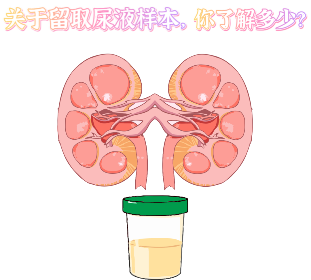 做尿檢，不得不說的注意事項(xiàng)！