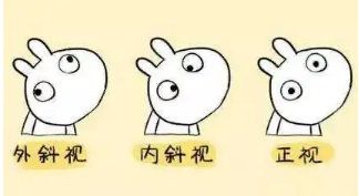 小baby老歪著頭？警惕斜頸! 這樣糾正……