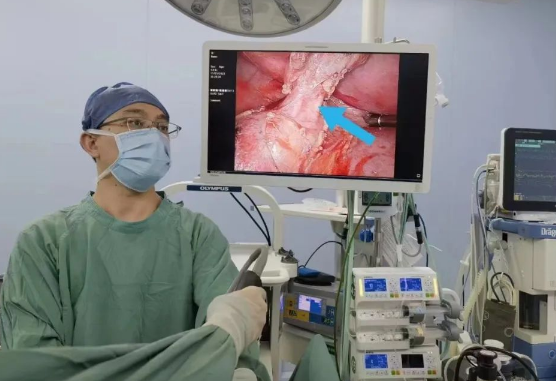 30歲小伙持續(xù)發(fā)燒咳嗽，原來(lái)是多長(zhǎng)一塊肺......