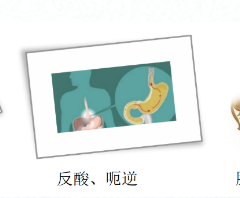 關(guān)愛(ài)身體健康，輕松檢查胃腸