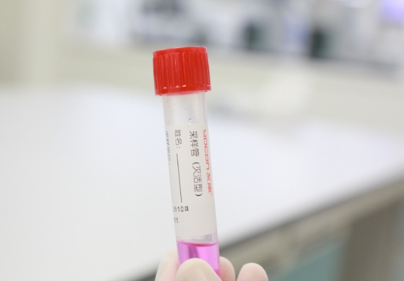 支原體感染檢測手段知多少？