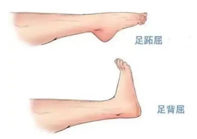 扭胯小連步、動(dòng)感搖花手……“科目三”雖火，運(yùn)動(dòng)損傷也要防！